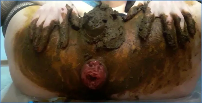 Scatlina mostra Prolasso anale nel proprio Scat - video scat